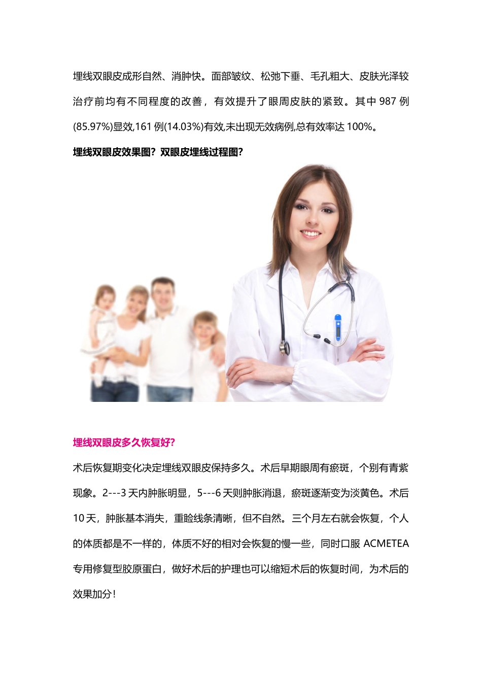 埋线双眼皮效果图？双眼皮埋线过程图？_第2页