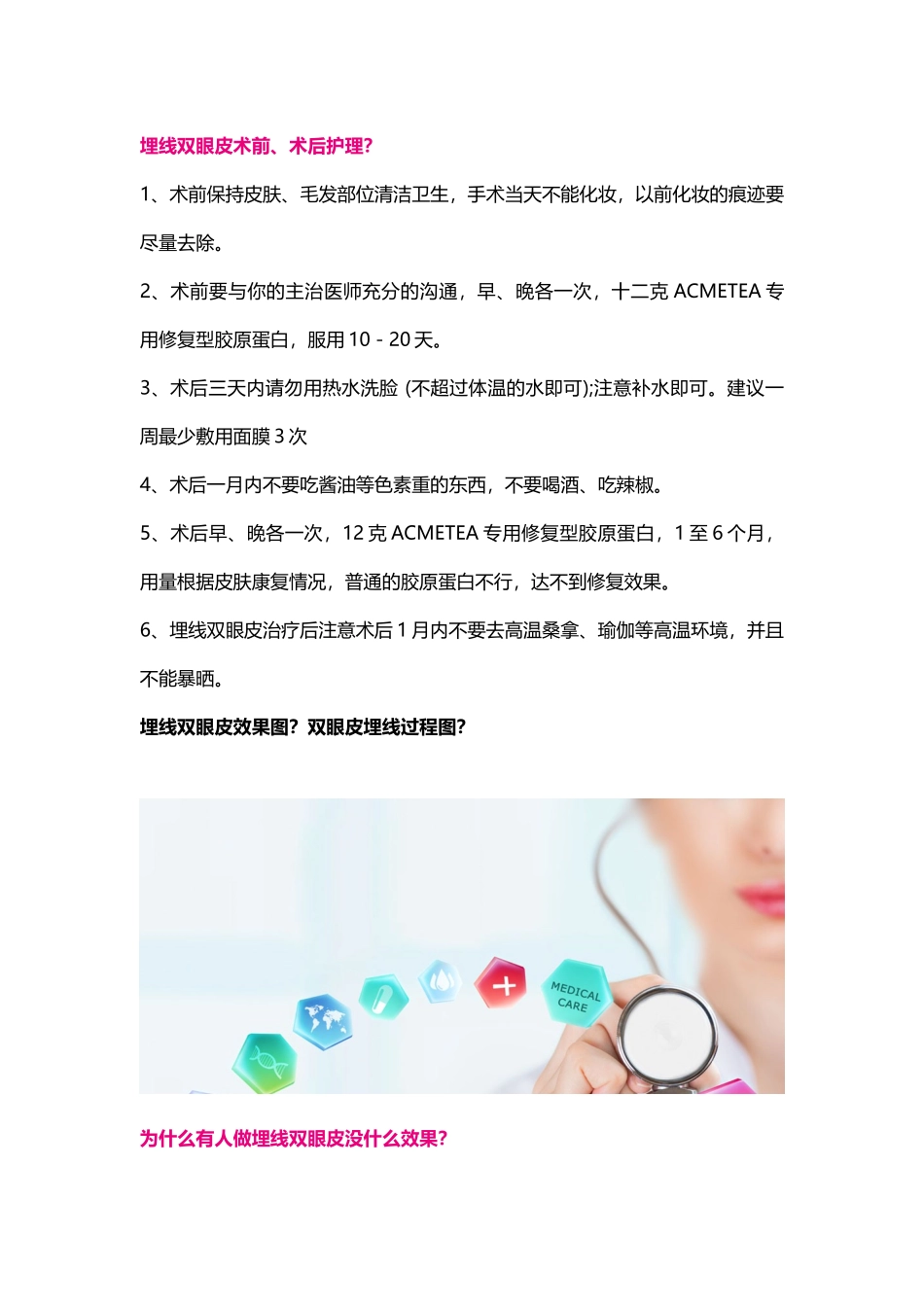 埋线双眼皮效果图？双眼皮埋线过程图？_第3页