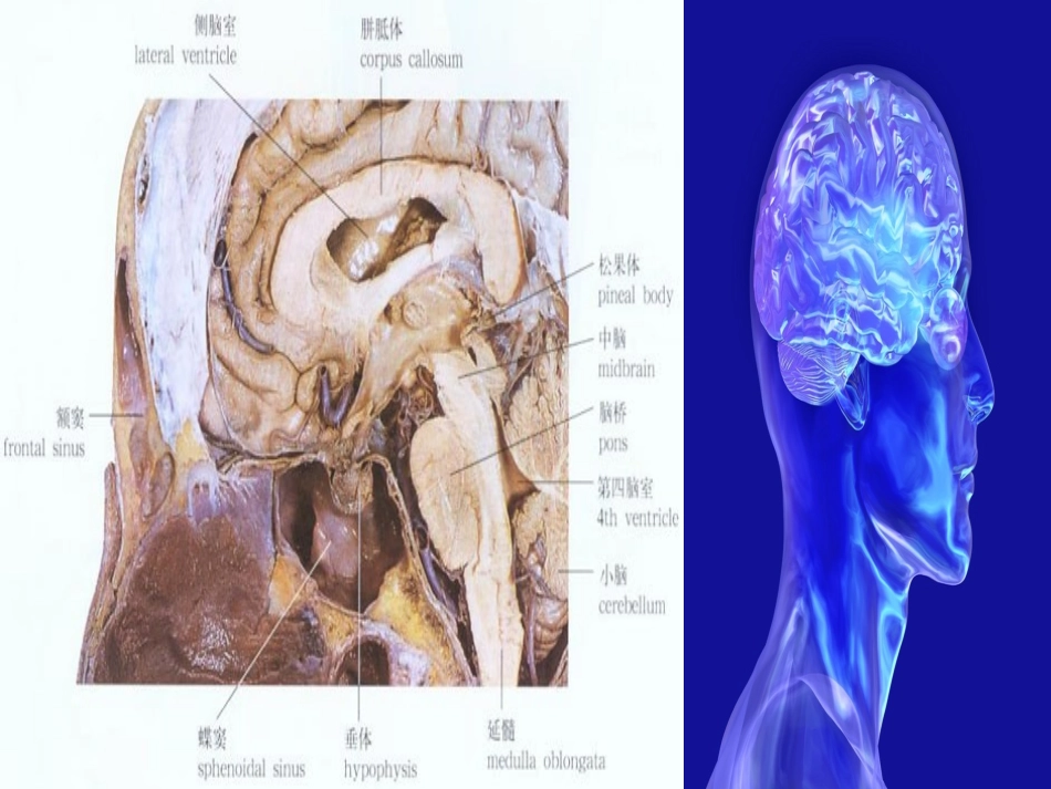 垂体瘤病人护理_第3页