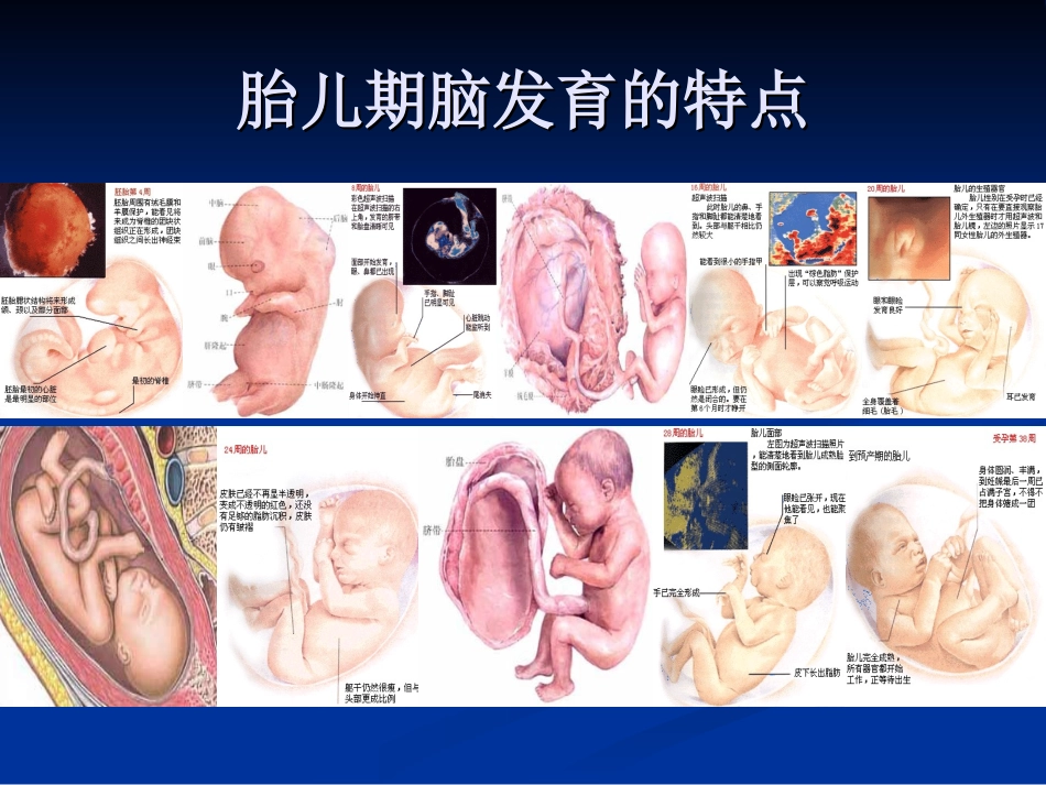 围产期因素与脑损伤ppt-._第2页