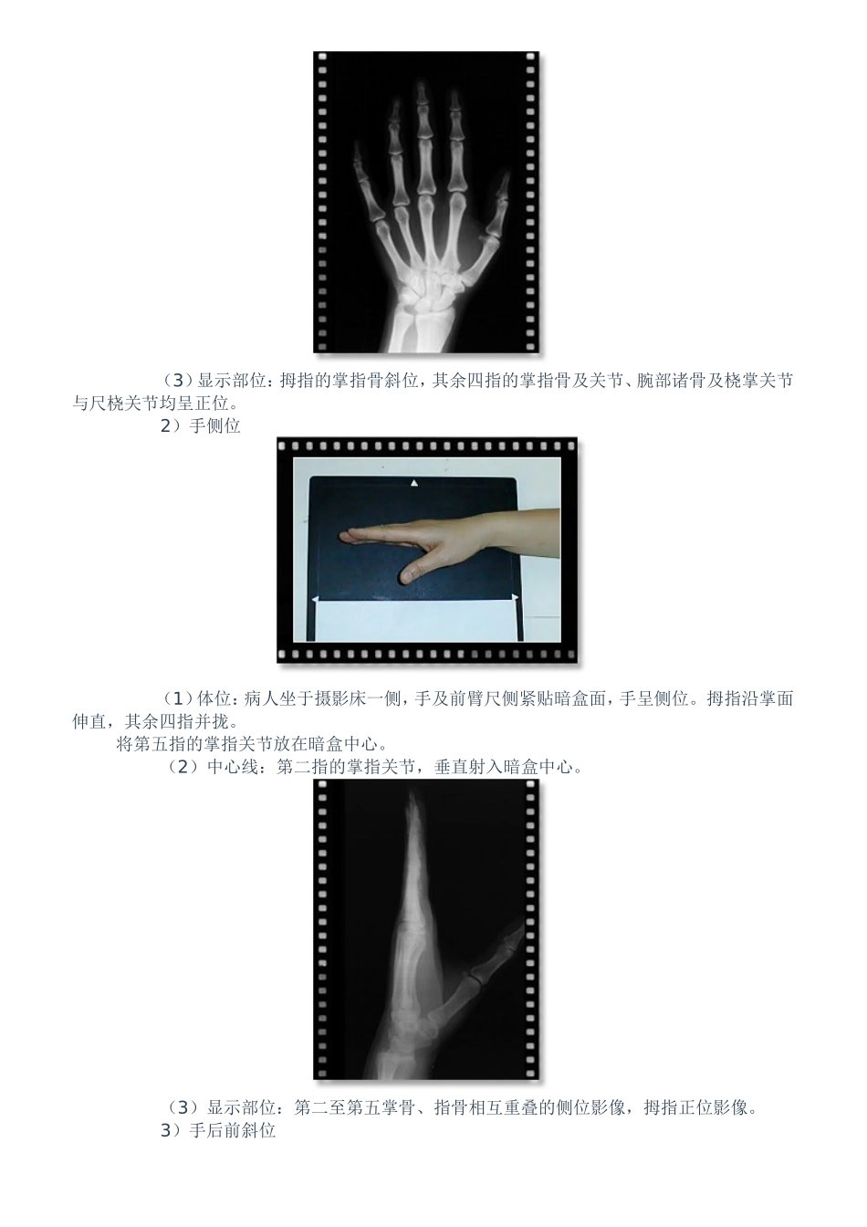 四肢摄影检查技术_第2页