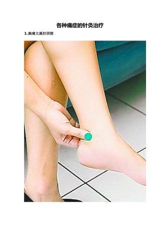 各种痛症的针灸治疗