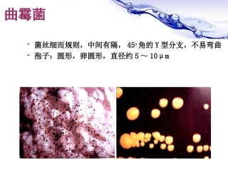 变应性支气管肺曲霉菌病ABPA