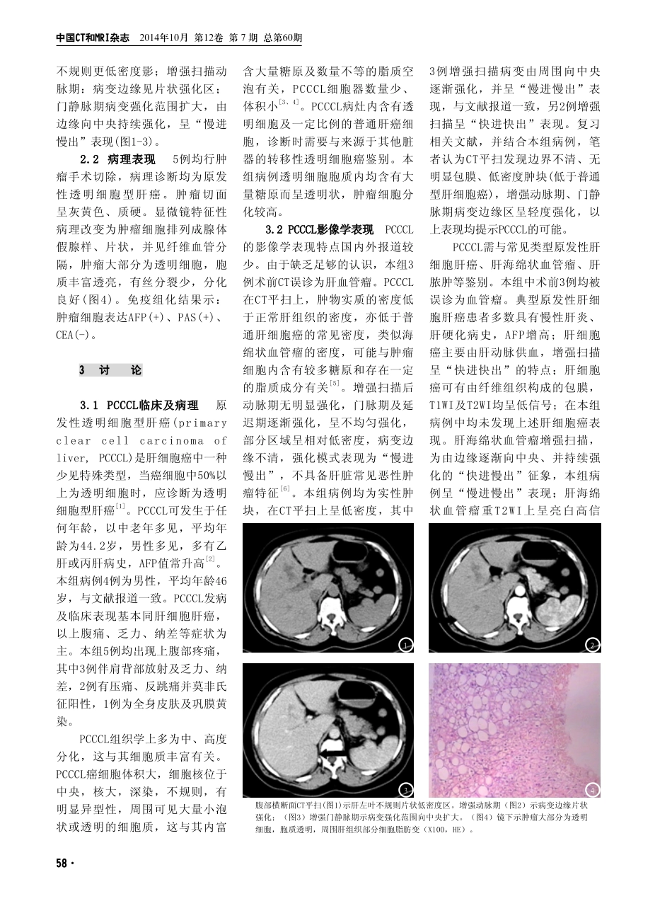 原发性透明细胞型肝癌的CT表现及其病理基础_第2页