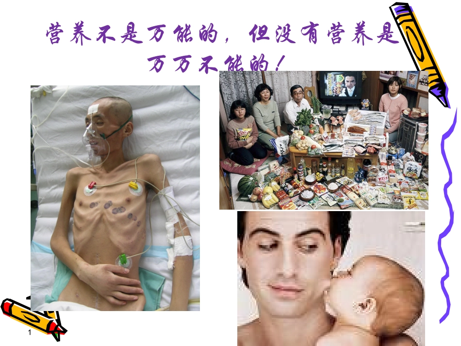 危重患者营养支持1_第1页