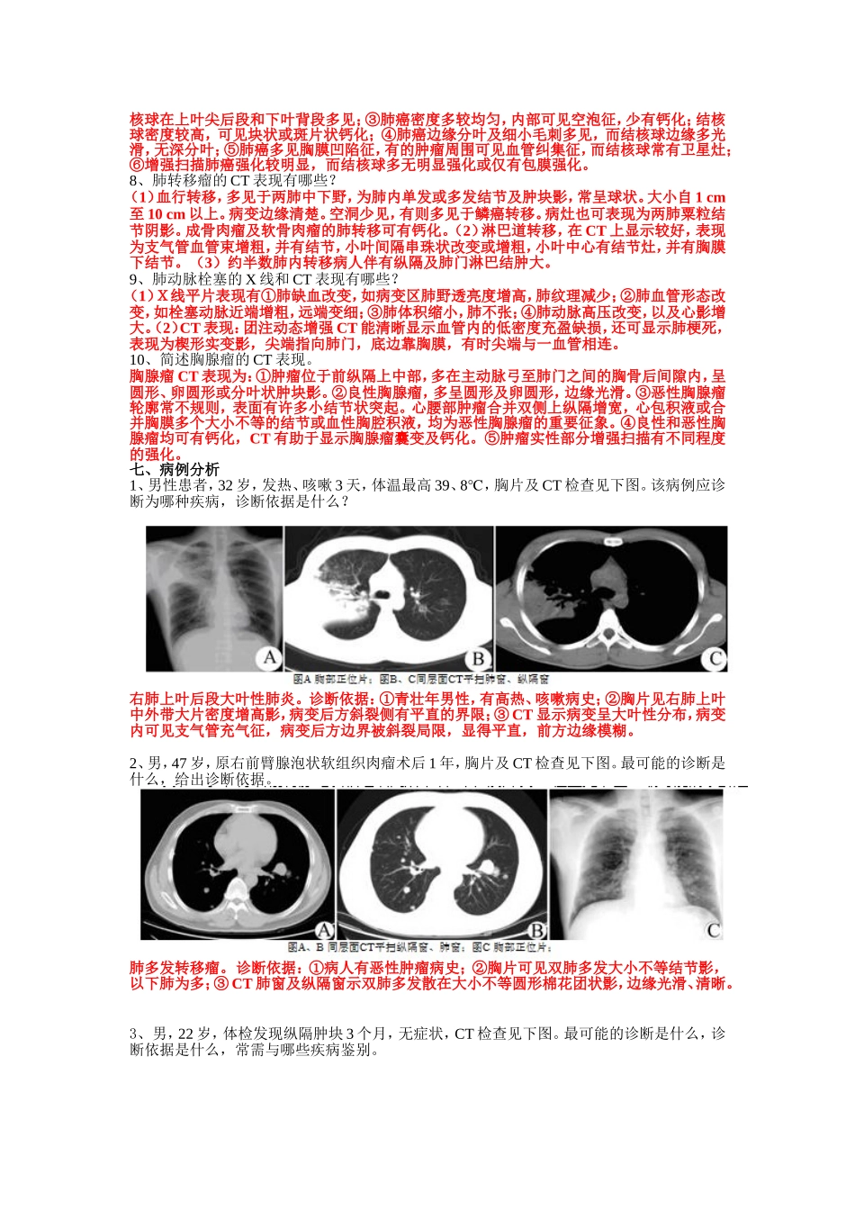南方医科大学影像学精品课程试题(呼吸系统)_第2页