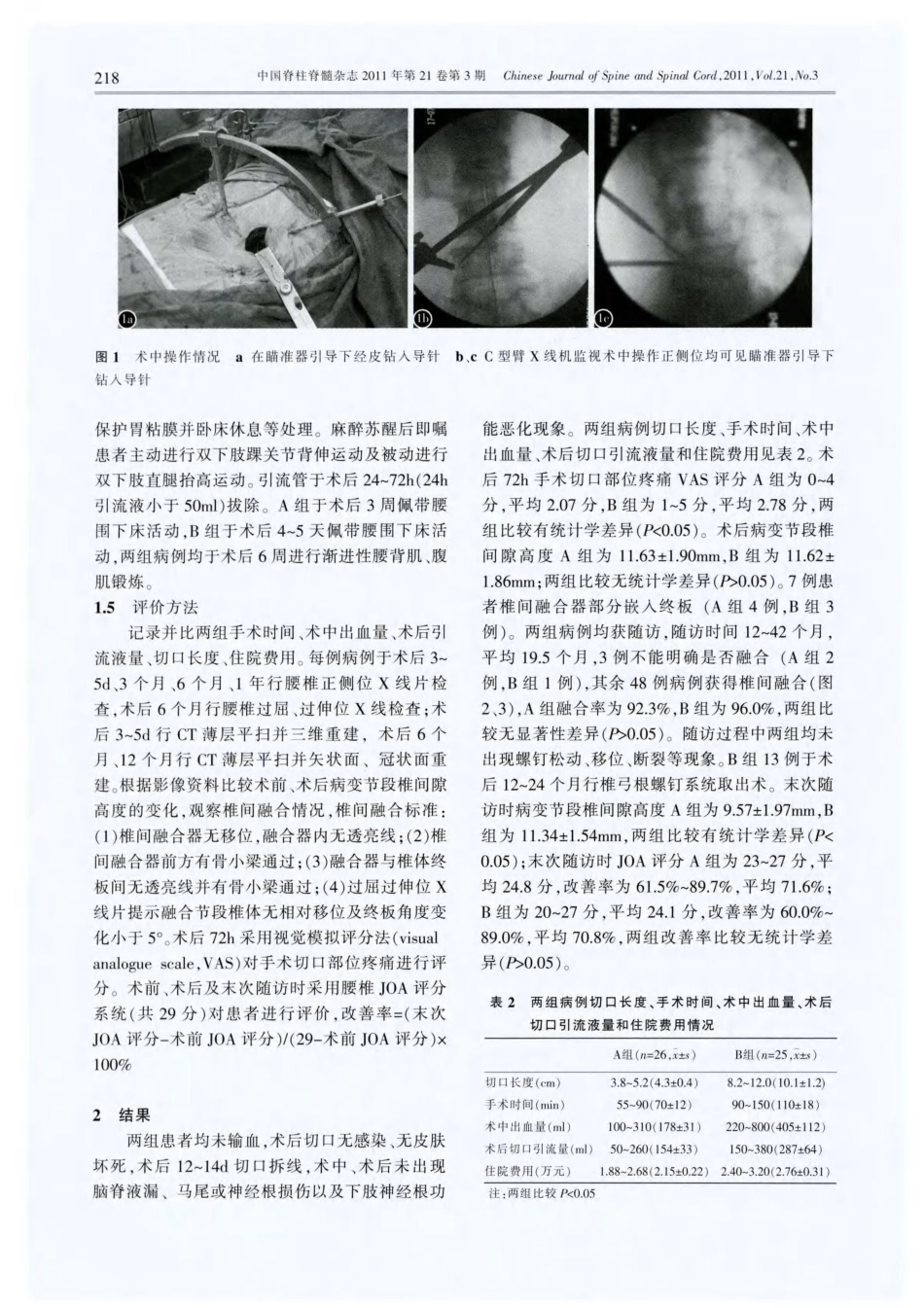 单侧椎板关节突螺钉固定与双侧椎弓根螺钉固定应用于下腰椎退变性疾病的比较_第3页