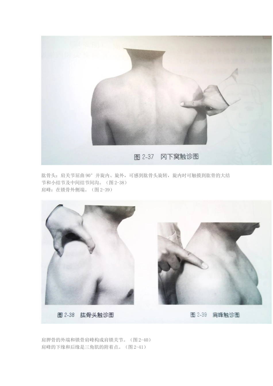 医生必须掌握的体表定位之肩部_第2页