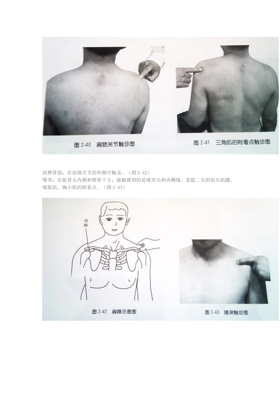 医生必须掌握的体表定位之肩部_第3页