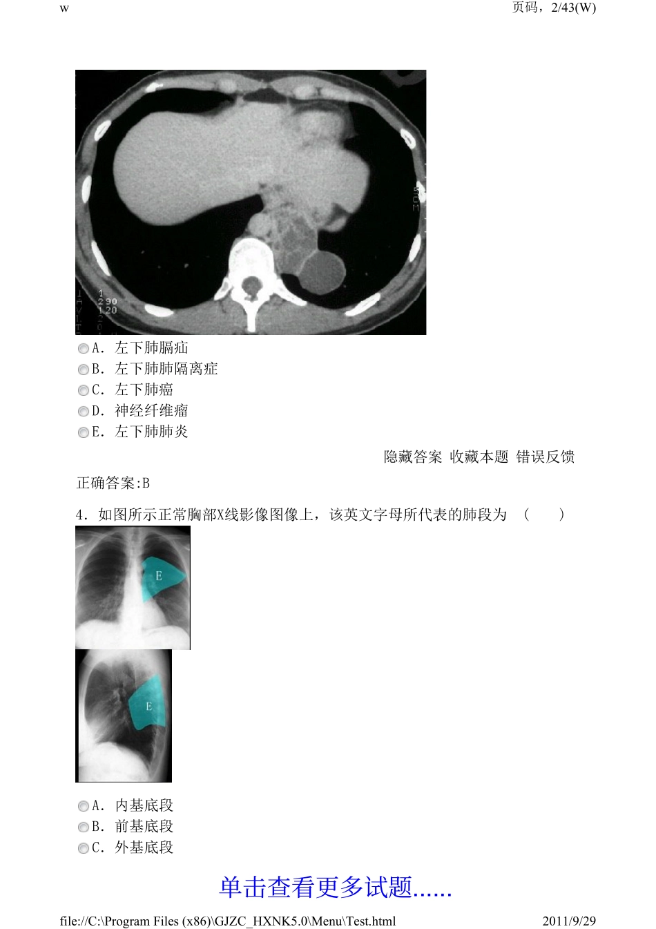 医学高级职称考试宝典2011版(呼吸内科)5.0 单选题1_第2页