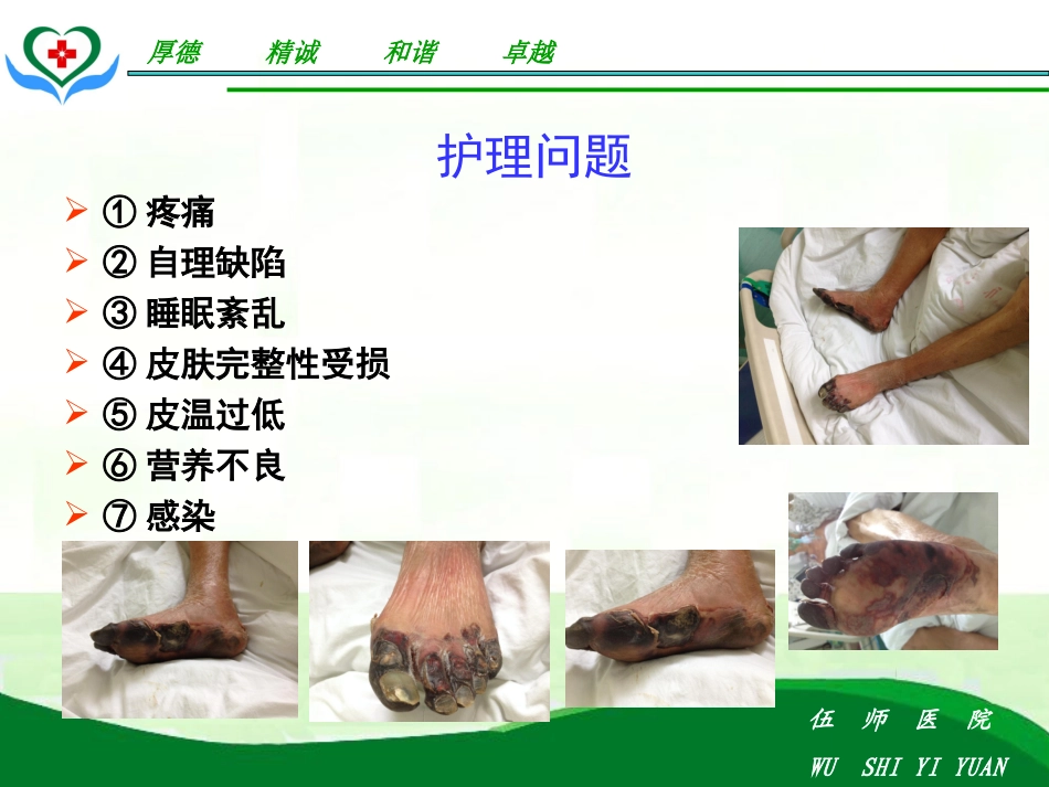 动脉血栓的护理查房_第3页