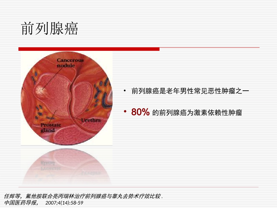 前列腺癌的诊治新进展_第3页