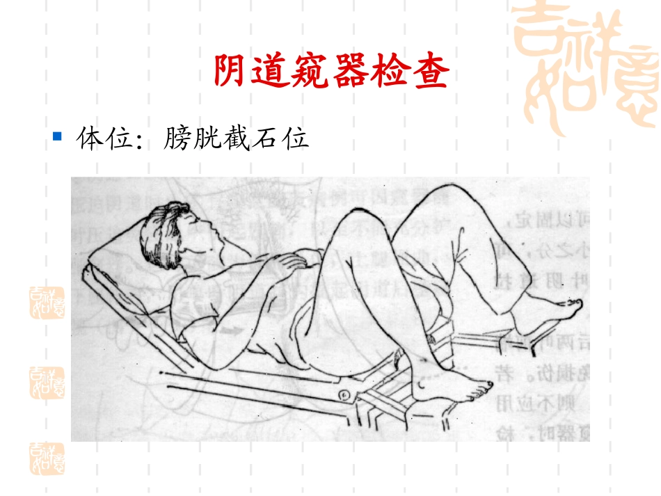 分泌物检查之宫颈脱落细胞学标本取材_第2页