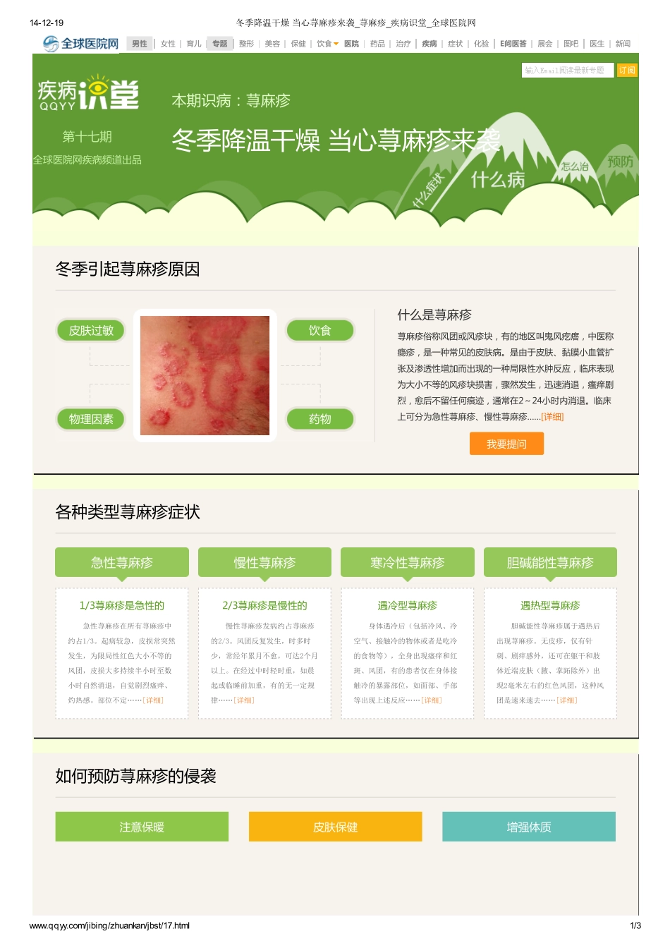 冬季降温干燥 当心荨麻疹_第1页