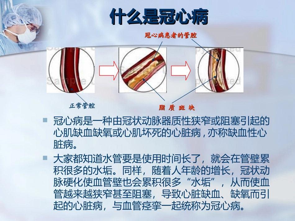 冠心病心绞痛的防治_第2页