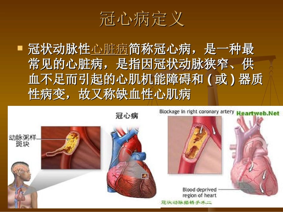 冠心病(CHD)_第2页