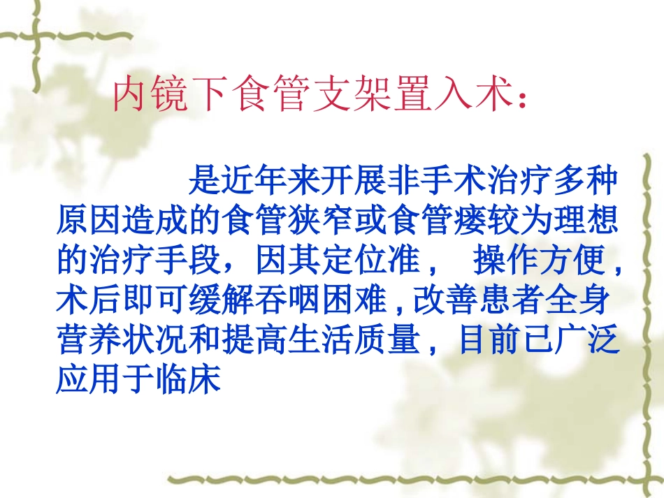 内镜下食管支架置入术_第2页