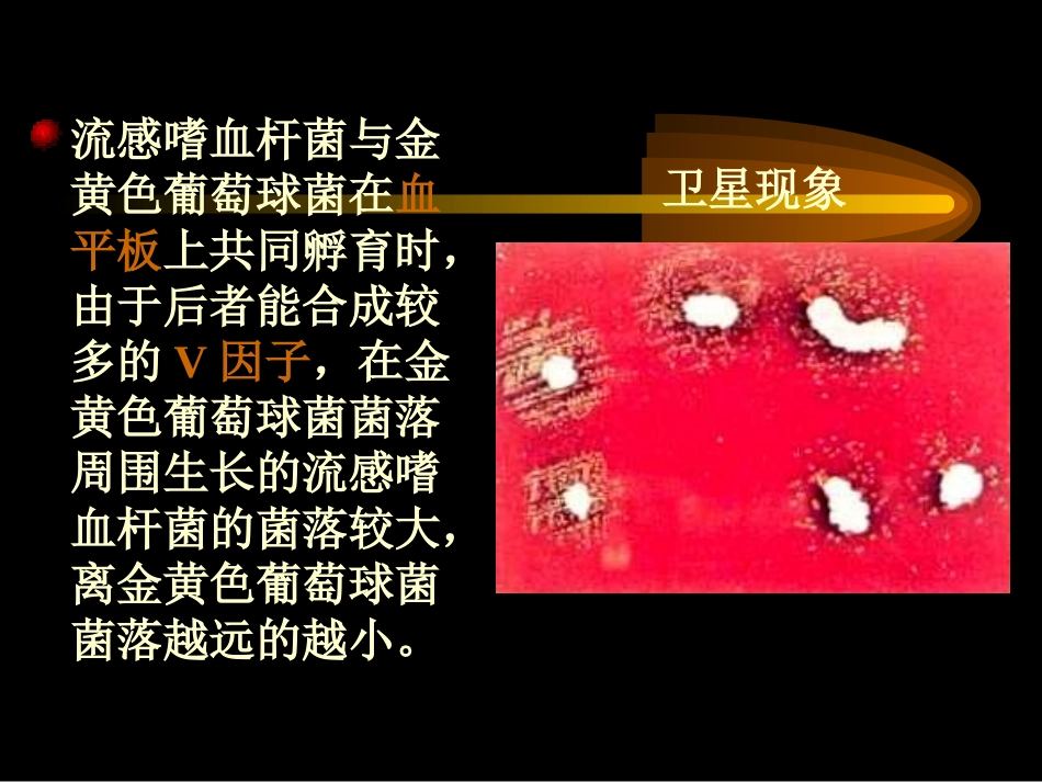 其他革兰阴性杆菌的常规检验_第3页