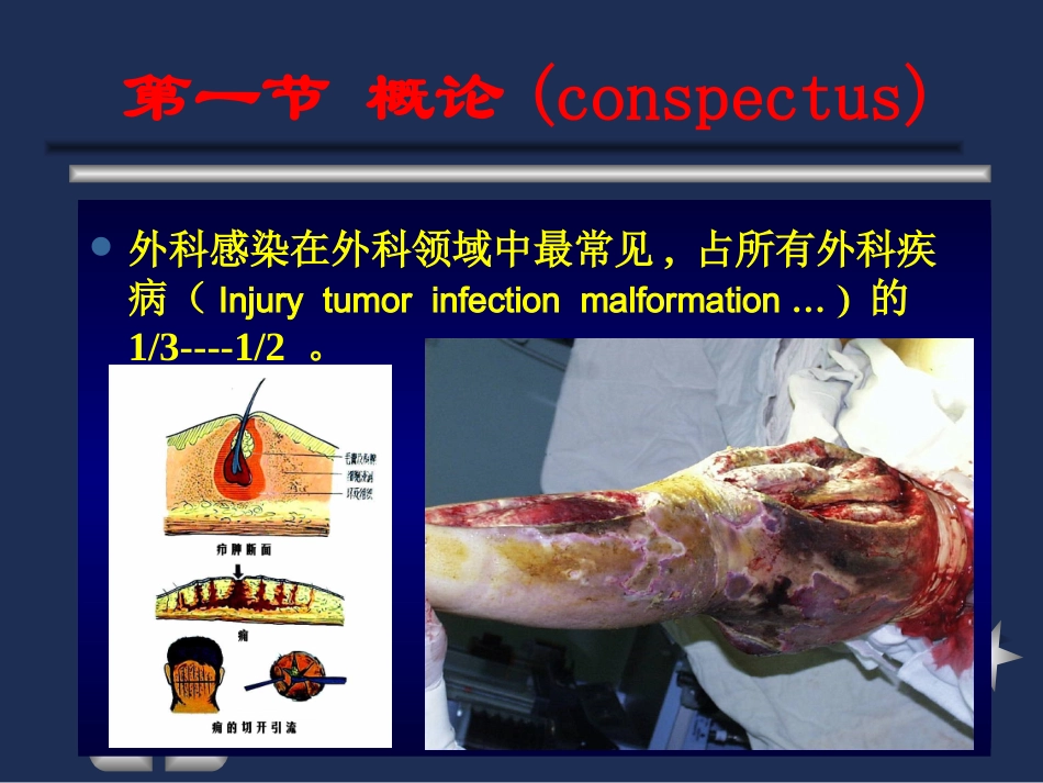 全身性外科感染_第2页