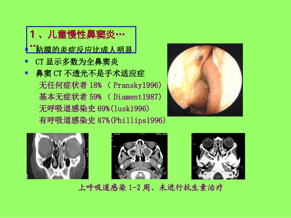 儿童鼻窦炎ppt_第3页