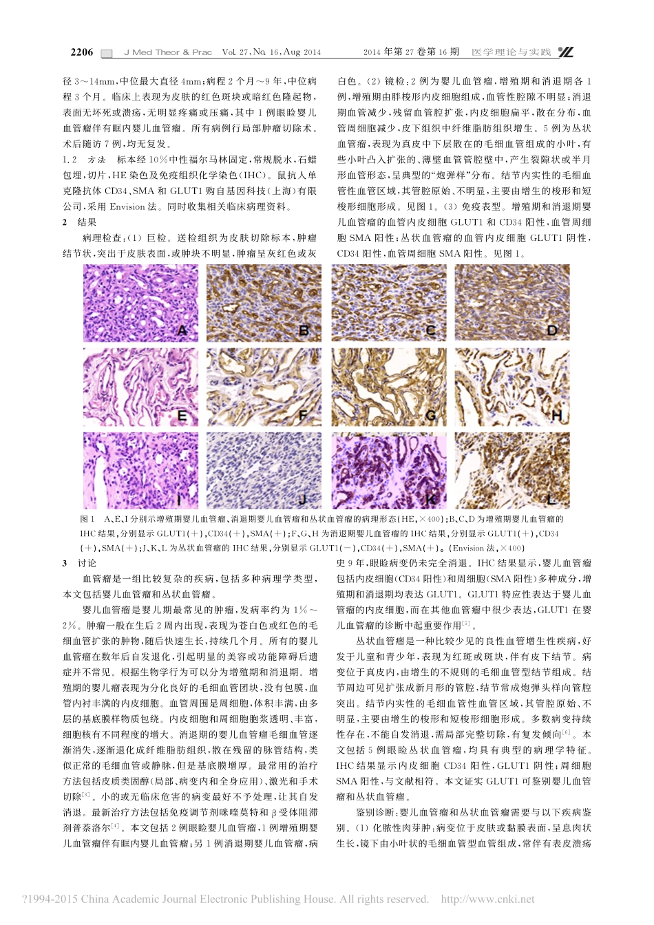 儿童眼睑血管瘤的临床病理分析_第2页