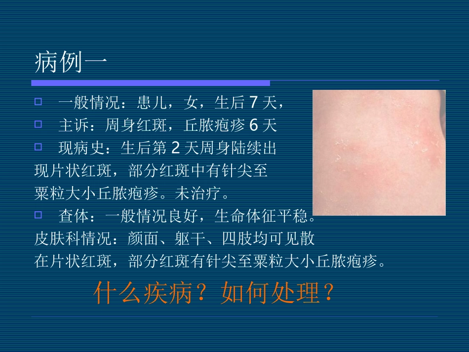儿童皮肤病之新生儿篇_第3页