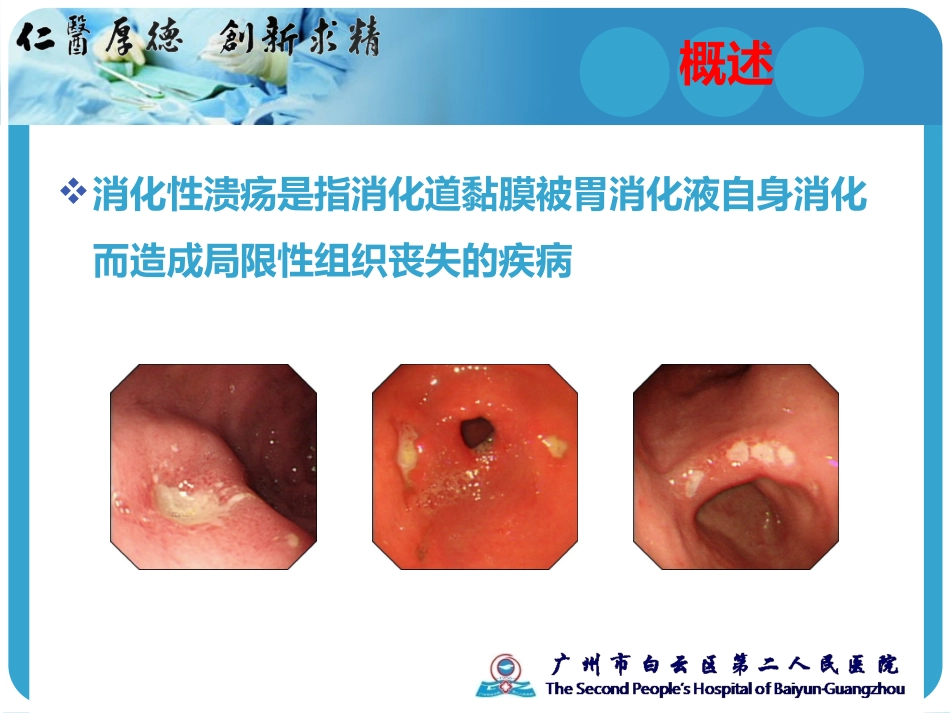儿童消化性溃疡的诊治_第3页