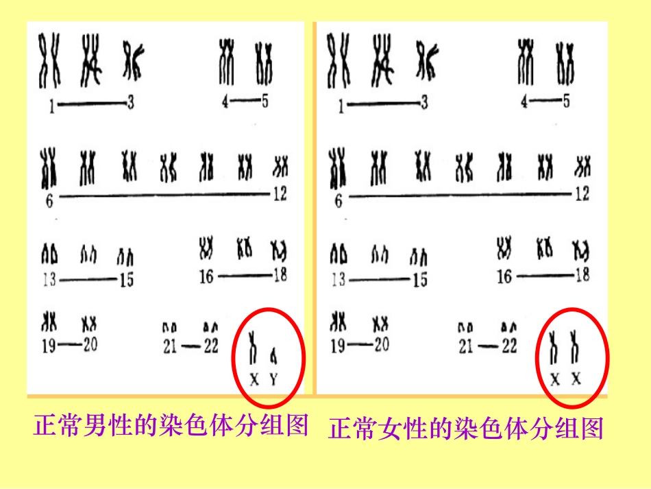 伴性遗传hgjdfghv_第3页