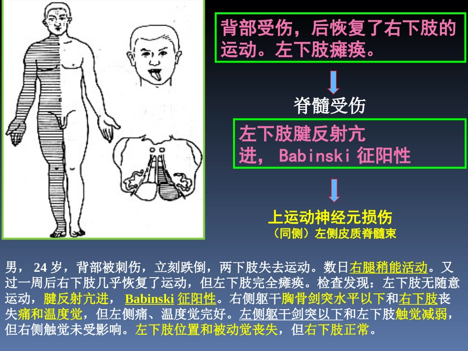 传导路病例讨论简述_第2页