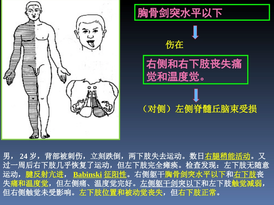 传导路病例讨论简述_第3页
