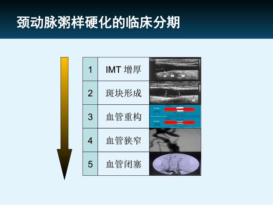 他汀在颈动脉粥样硬化中的证据_第3页
