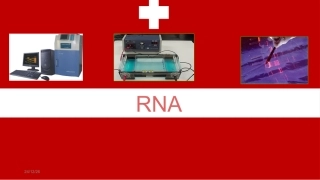 人类细胞质RNA提取RTPCR的原理方法琼脂糖凝胶电泳结果分析及其应用分析