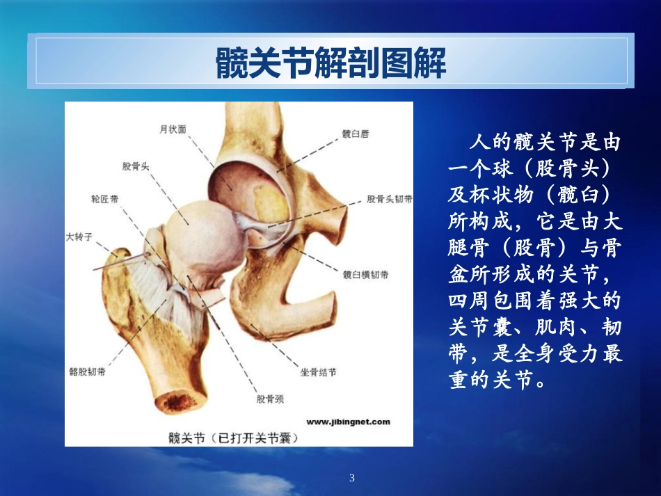 人工髋关节置换术(ppt)_第3页