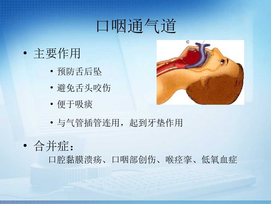 人工气道管理-徐琳静_第3页