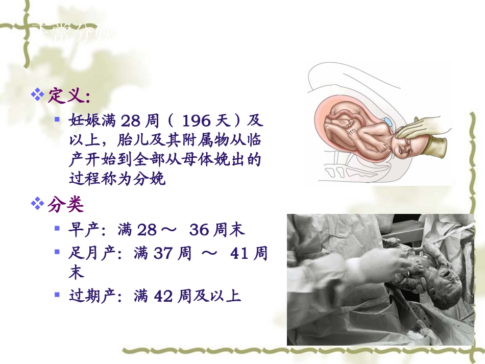 产程观察与处理_第2页