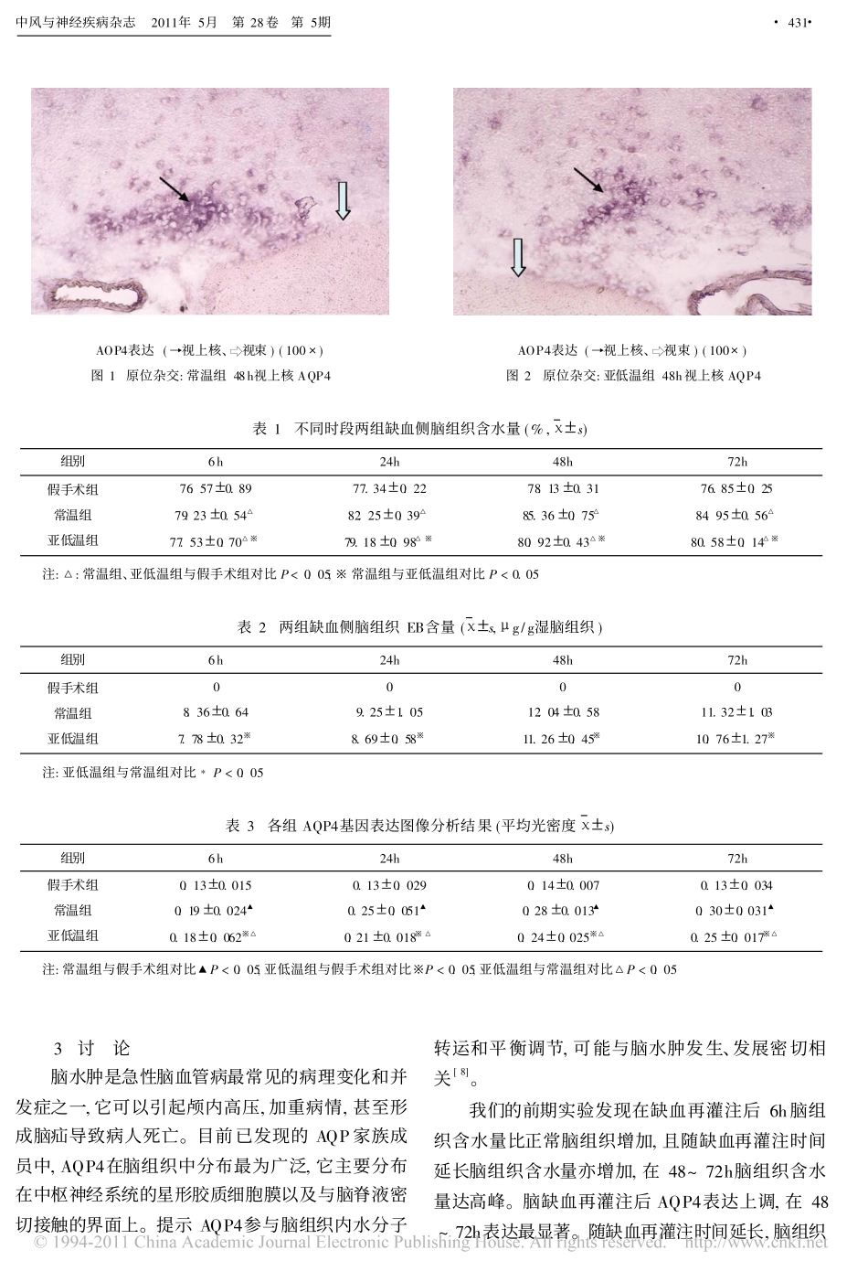 亚低温治疗对脑缺血大鼠AQP4基因表达及血脑屏障通透性的影响_第3页