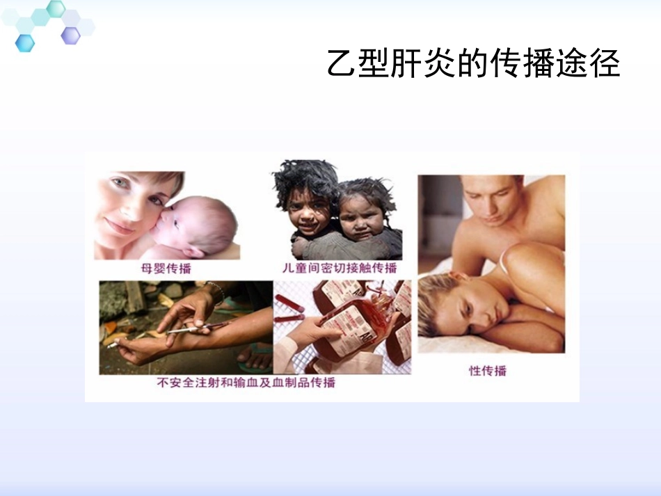 乙型肝炎的母婴传播_第3页