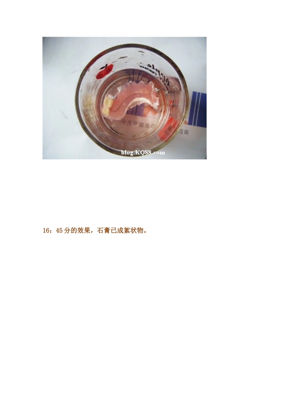义齿固位力的思索与实践_第3页