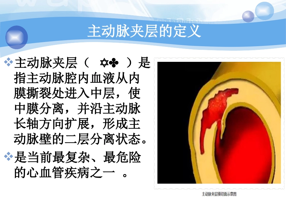 主动脉夹层的急救处理_第3页