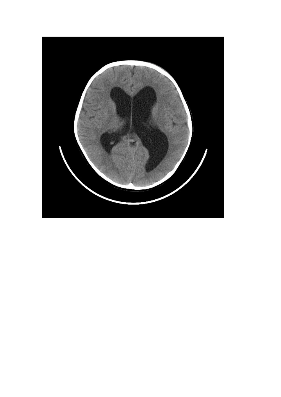 丹瓦氏畸形。_第2页