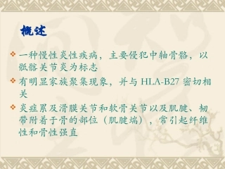 中西医结合骨伤-强直性脊柱炎