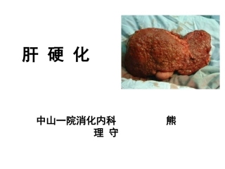 中山肝硬化概述