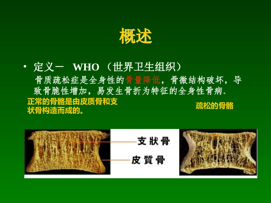中国骨质疏松诊治指南(新)ppt_第3页