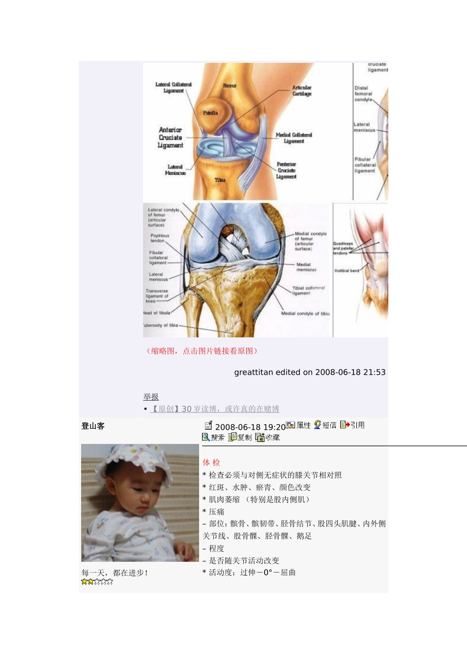 专题讲座】膝关节疼痛的诊断与鉴别诊断_第2页