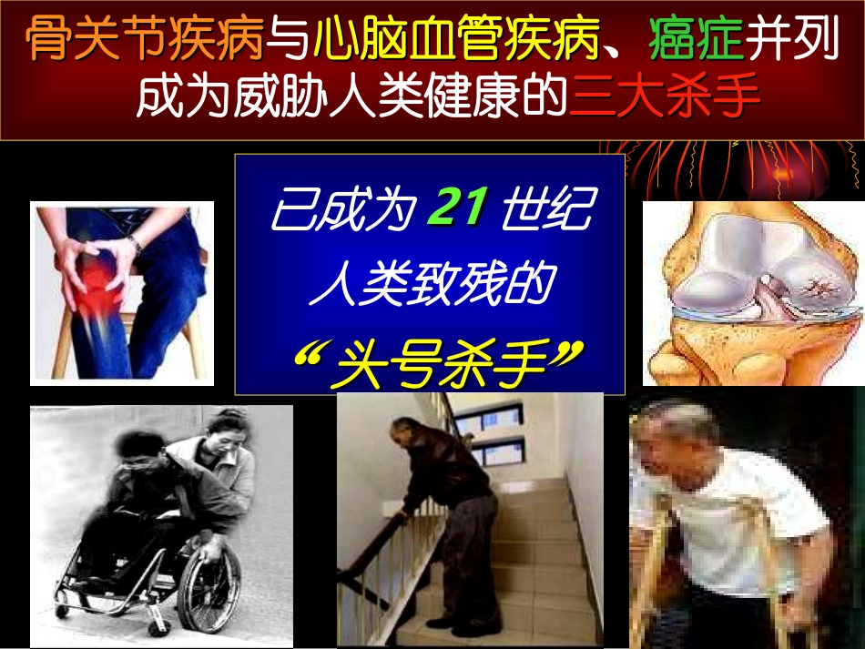 不死的癌症-骨关节病_第2页