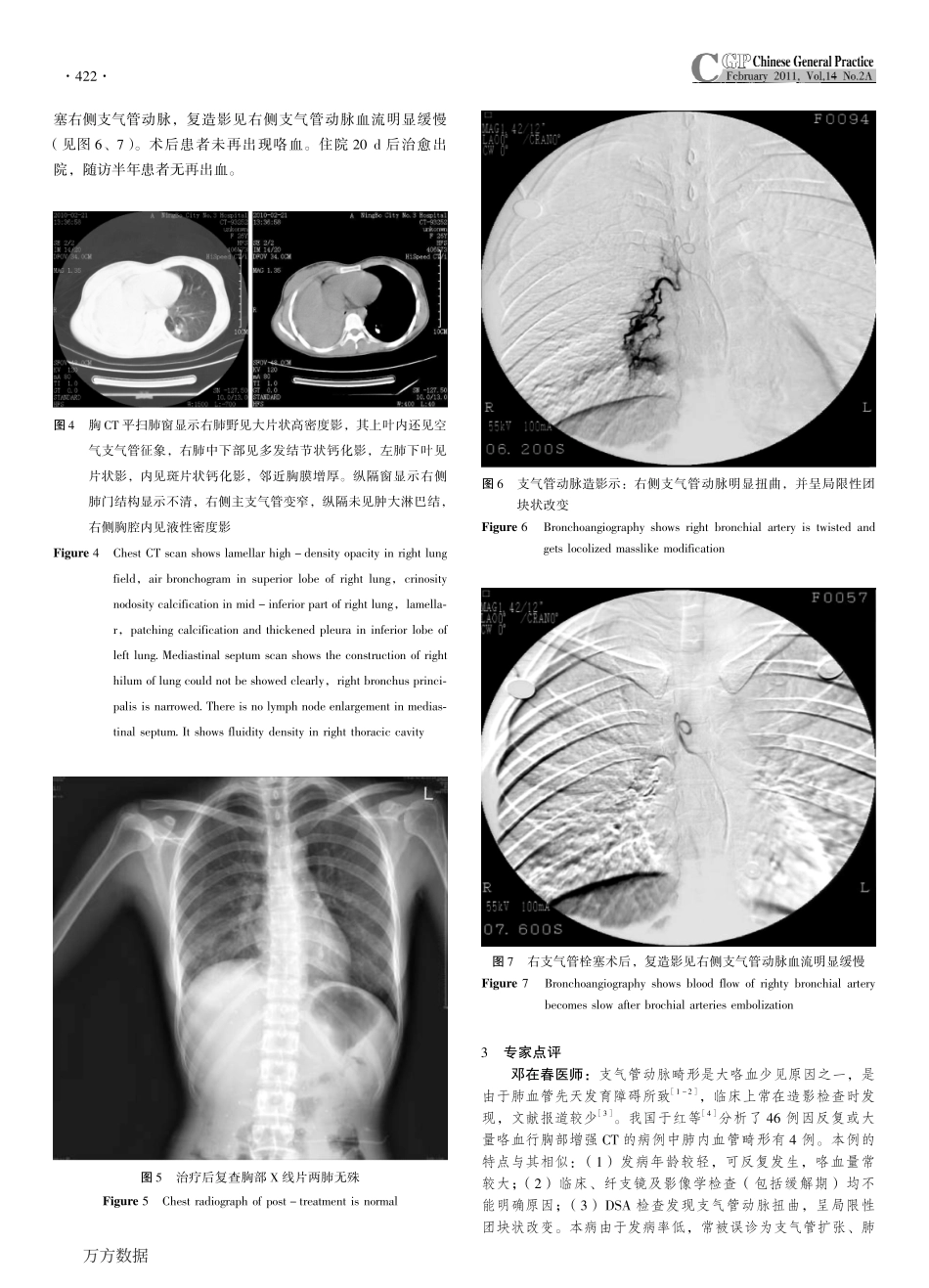 不明原因大咯血_第3页