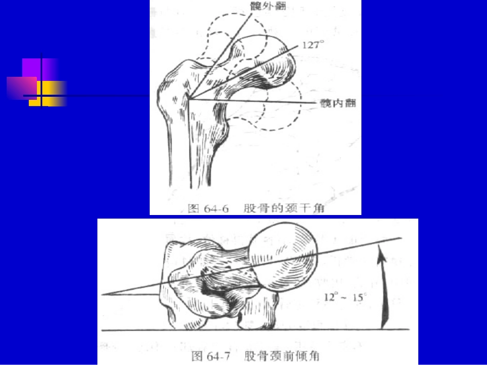 下肢骨折牵引图片2材料_第3页