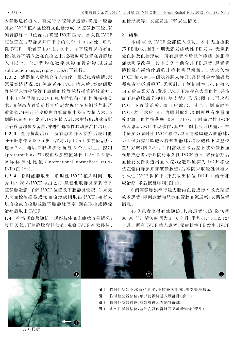 下肢深静脉血栓治疗与腔静脉滤器的使用_第2页