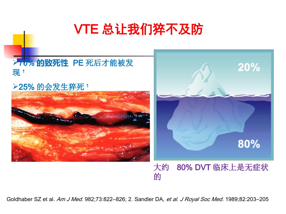 下肢深静脉血栓讲课_第3页