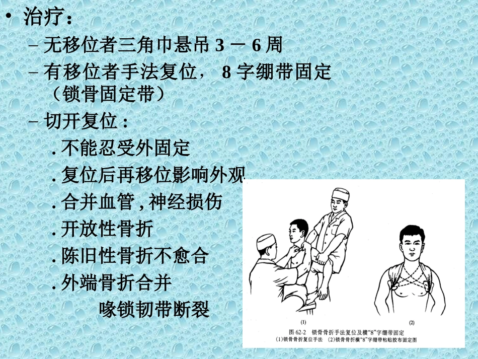 上肢骨、关节损伤_第3页